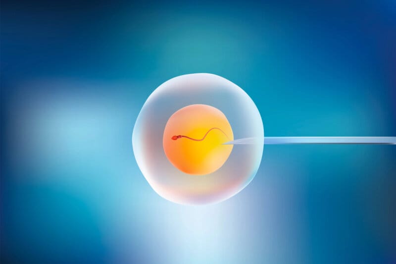 Künstliche Befruchtung Ivf Oder Icsi Unterschied Natürlicher Und Stimulierter Zyklus